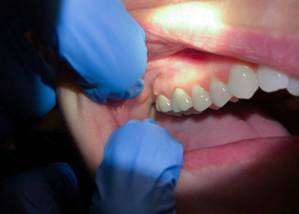Best Urgent Dental Care for Toothache in Lake Dalecarlia, IN